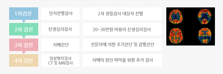 1차검진(인지선별검사, 2차 정밀검사 대상자 선별)
                                2차 검진(신경심리검사, 20-30만원 비용으로 신경심리검사)
                                3차 검진(치매진단, 전문의에 의한 조기진단 및 감별진단)
                                4차 검진(임상병리검사 CT 및 MRI검사) 치매의 원인 파악을 위한 추가 검사 